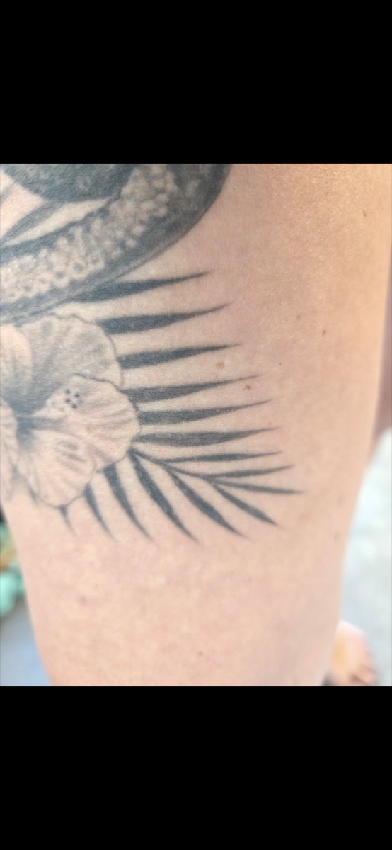 Tattoo ungeschützt vor der Laser-Haarentfernung